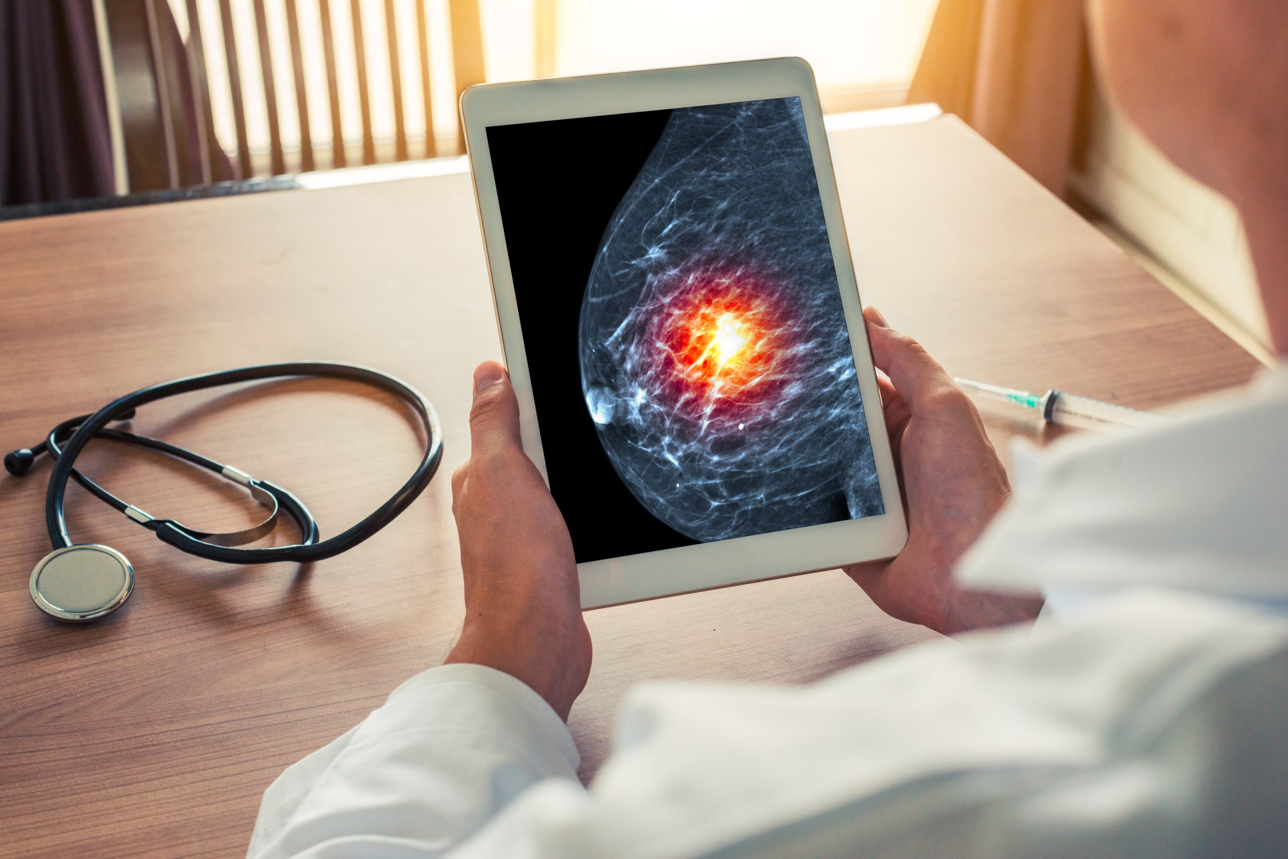 Brustkrebsbehandlung im Wandel: Hoffnung auf Therapie ohne Chemo