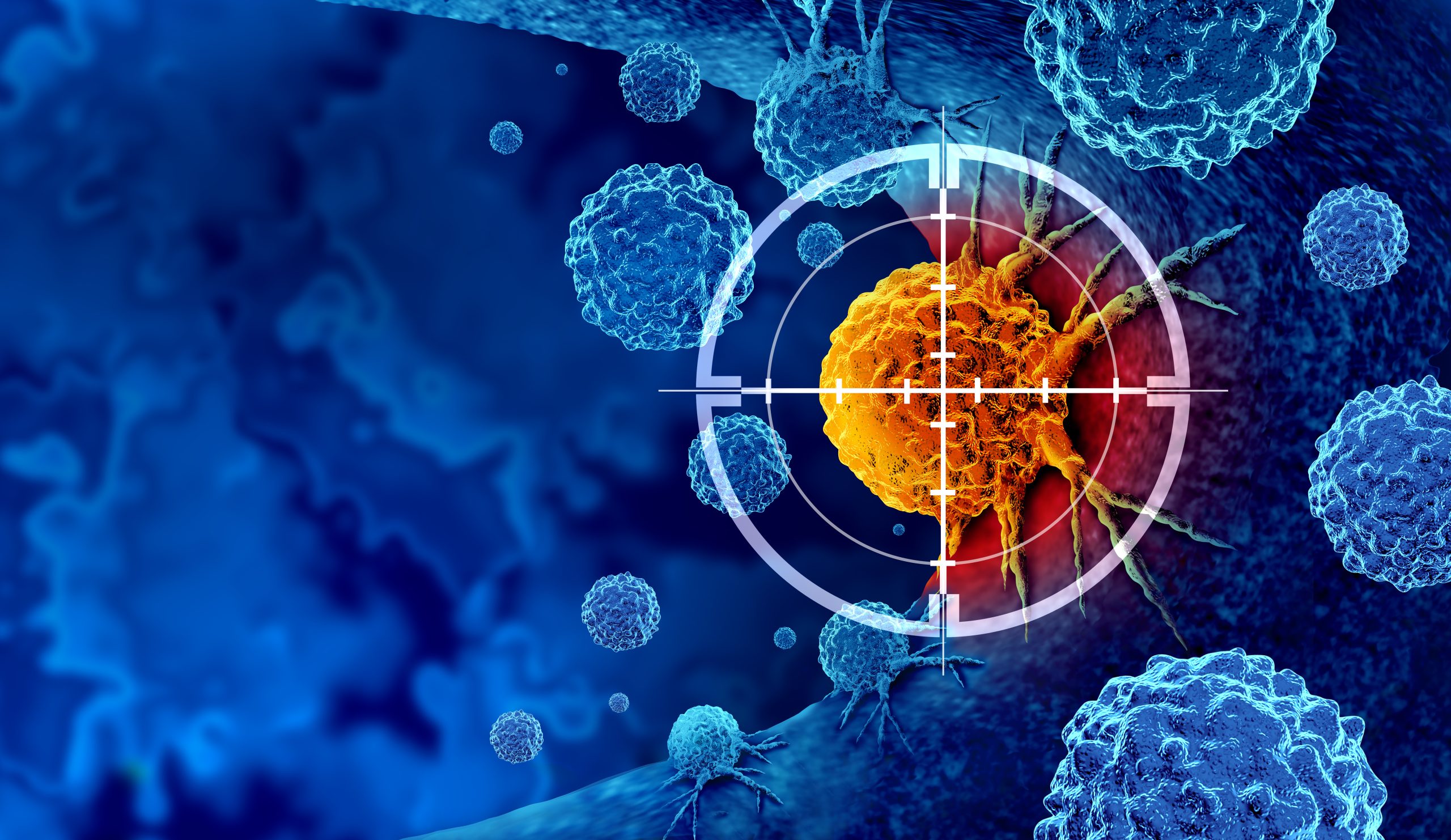 Personalisierte Brustkrebs-Therapie: Vorteile durch Biomarker